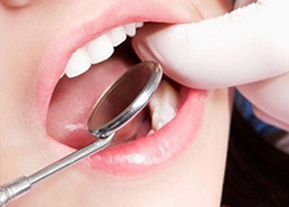 Extractions & Oral Surgery